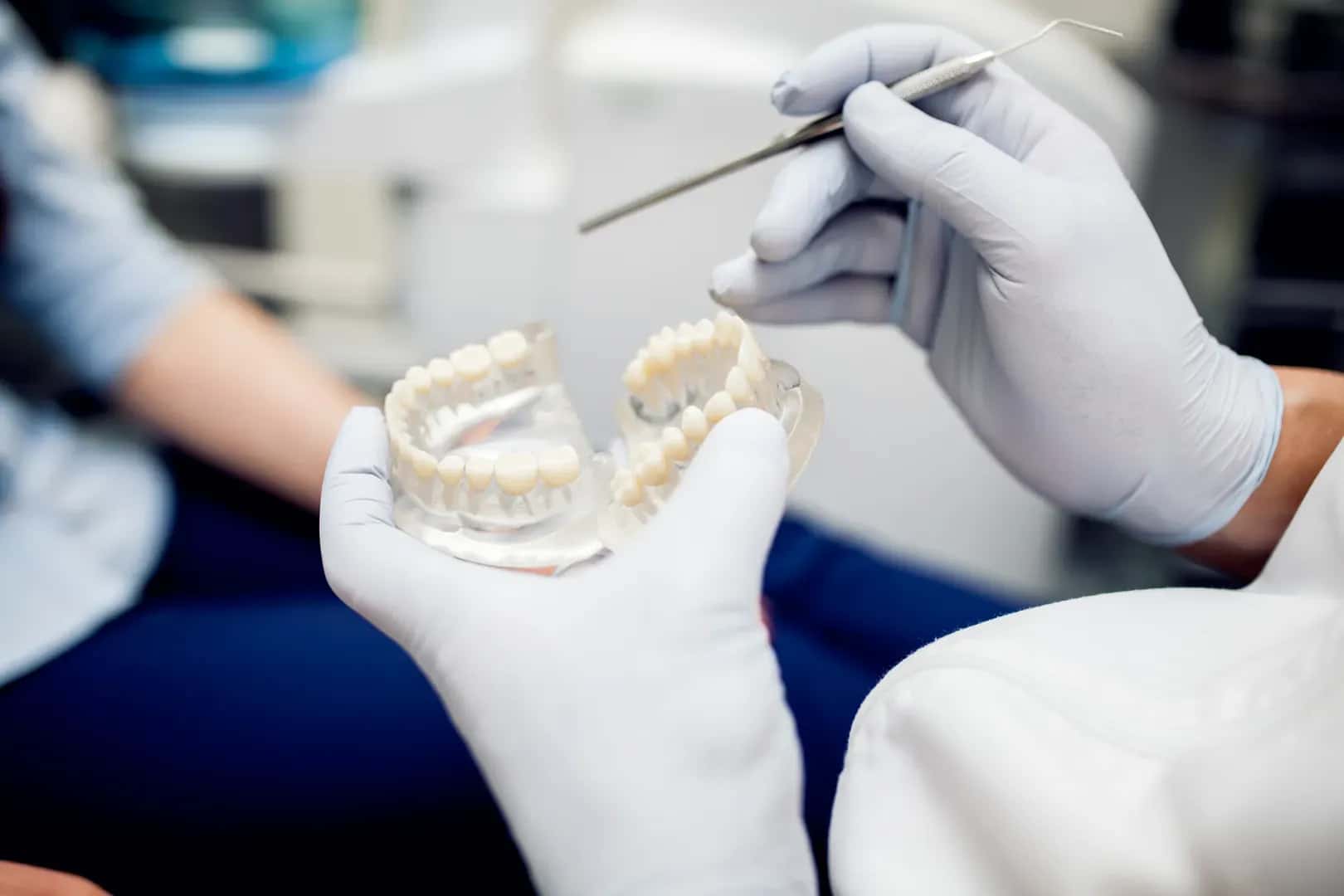 ¿Los implantes dentales producen cáncer o es un mito?