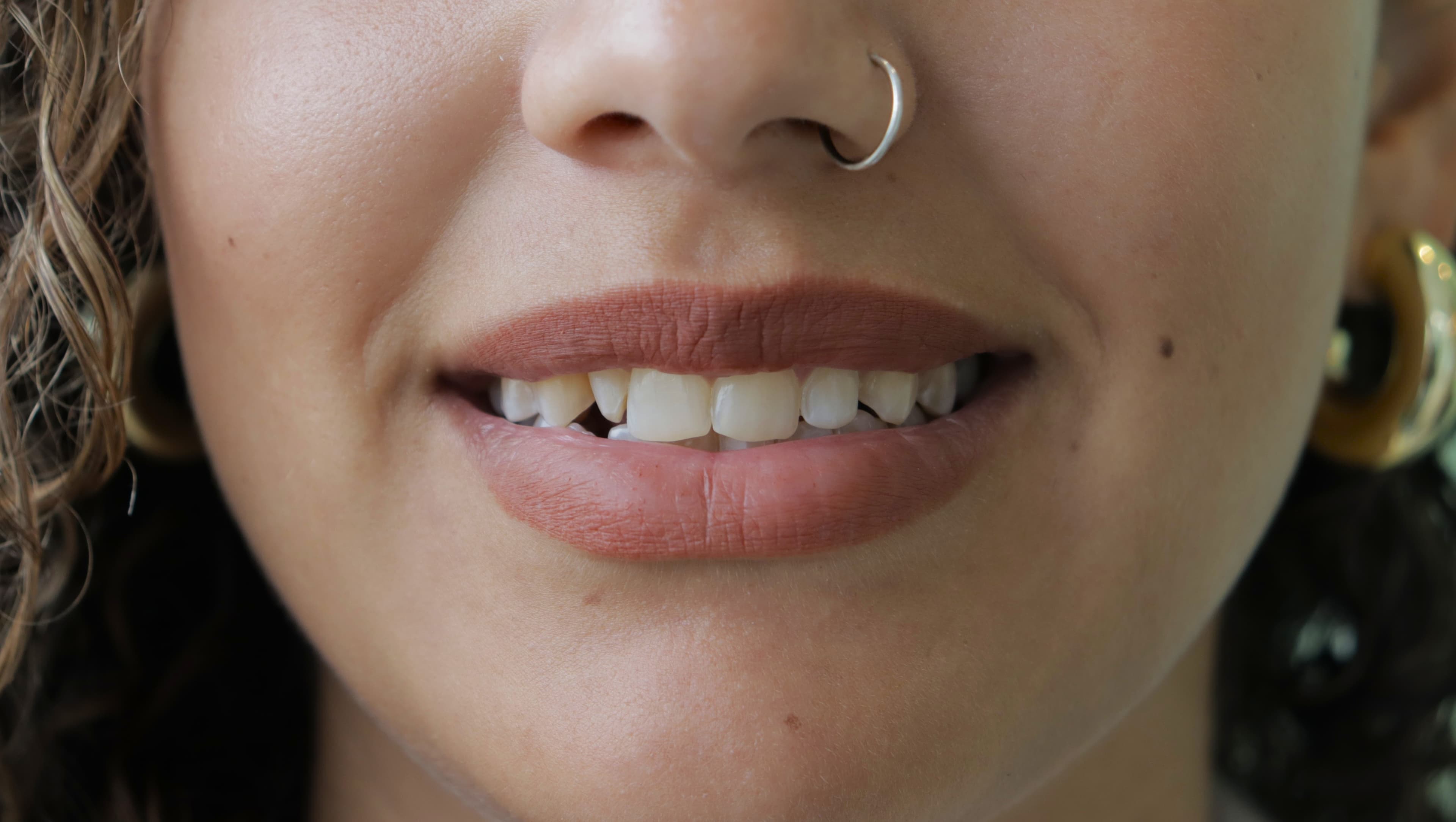 Before Lentes Cerámicos Naturales