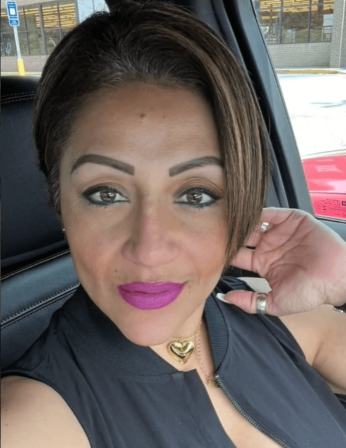 After Armonización facial