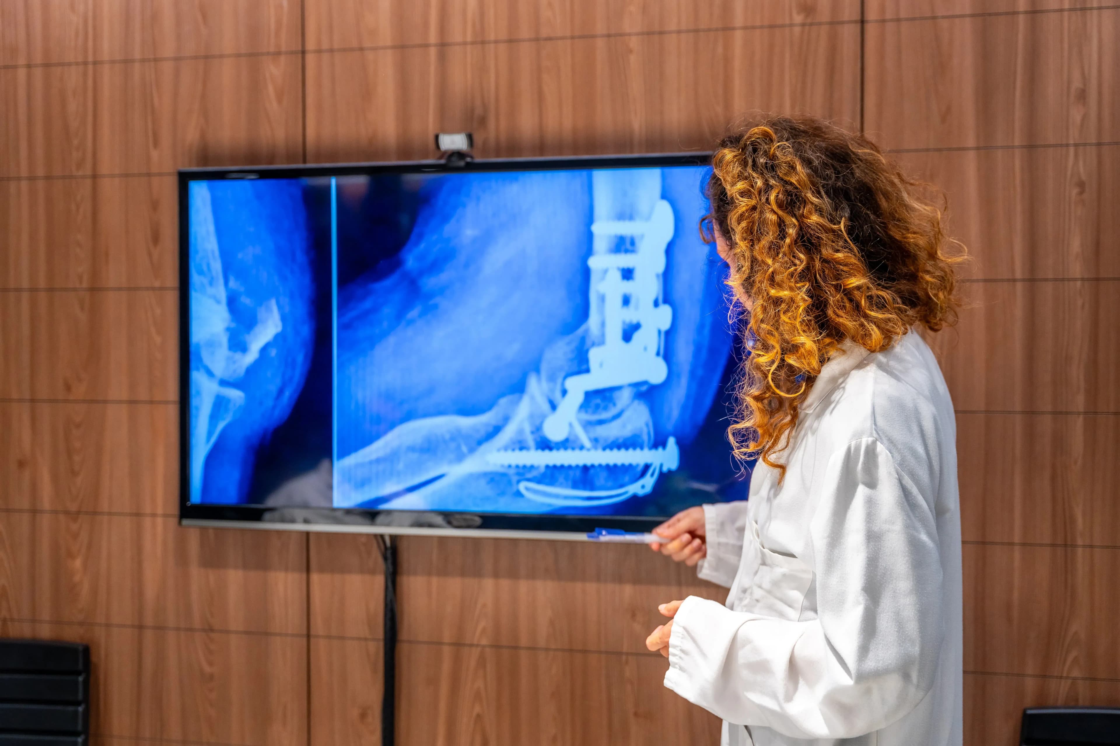 Doctora revisando la radiografia y protesis