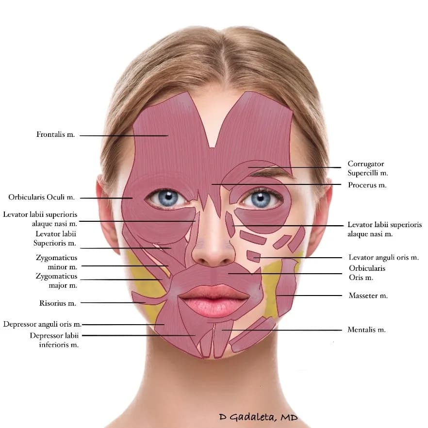 Diferente lugares donde colocare el botox