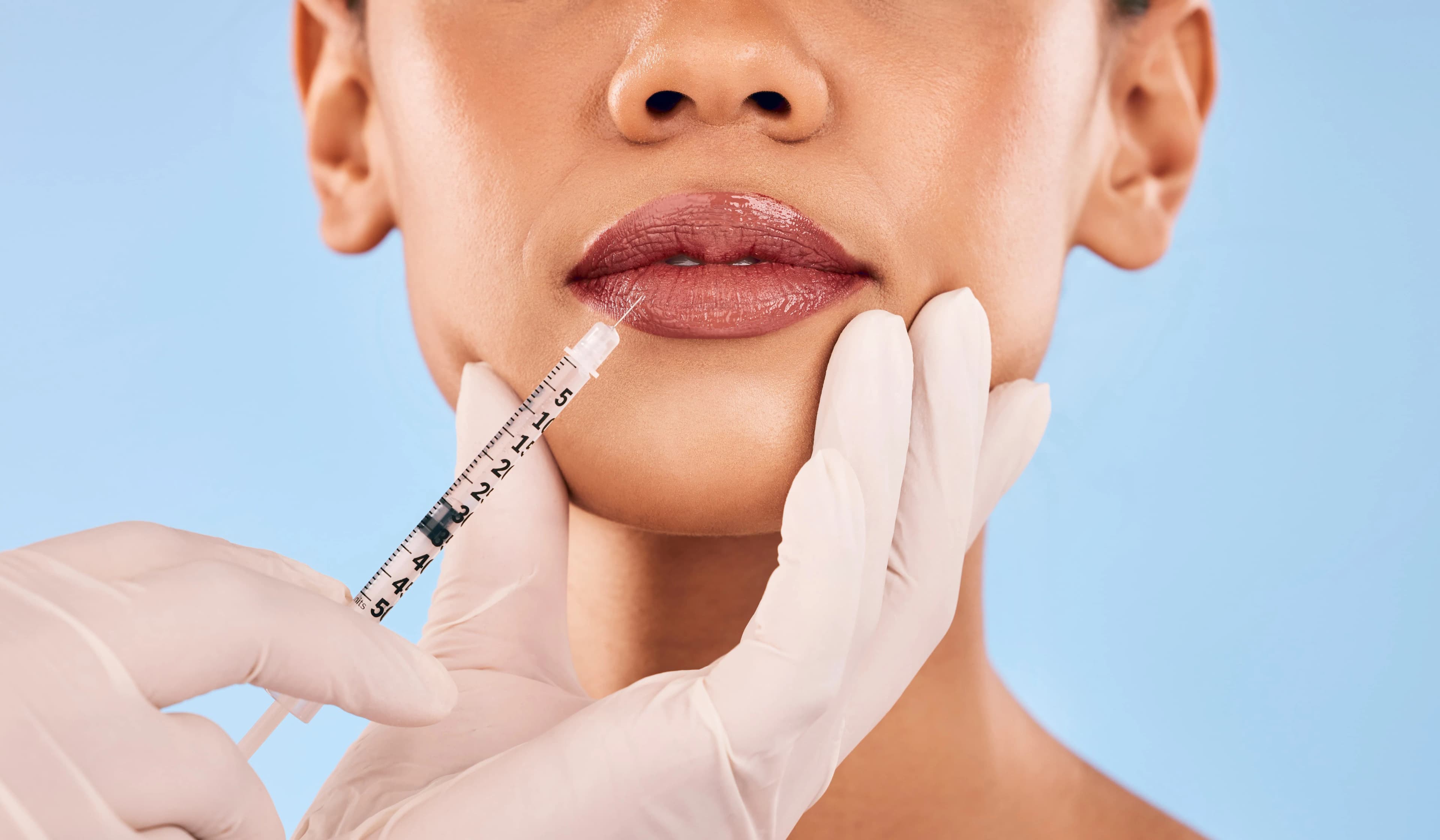 Injectando filler