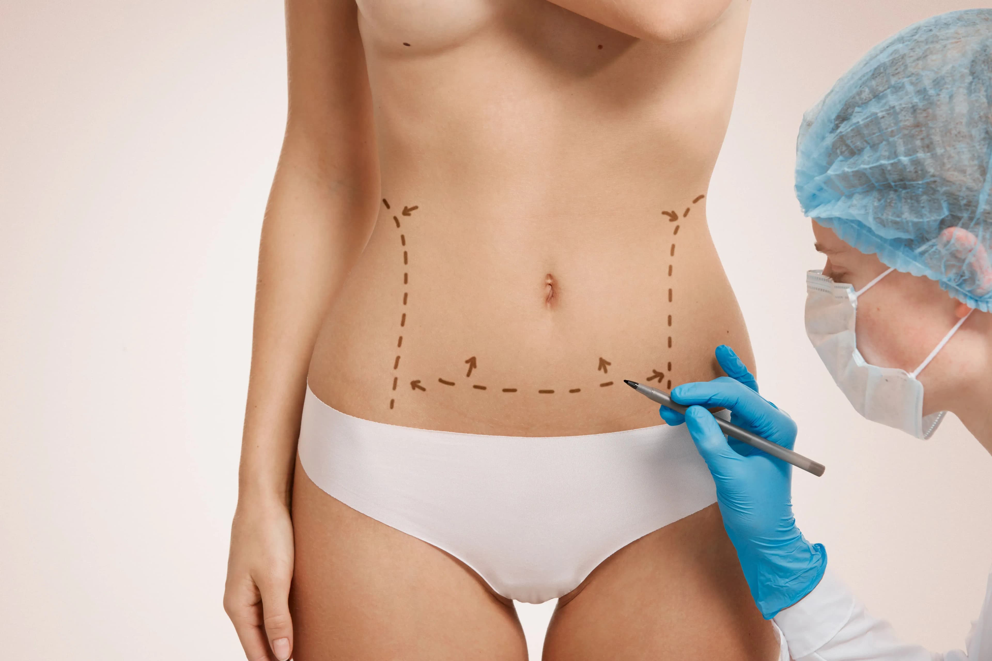 Mujer marcada para la cirugía