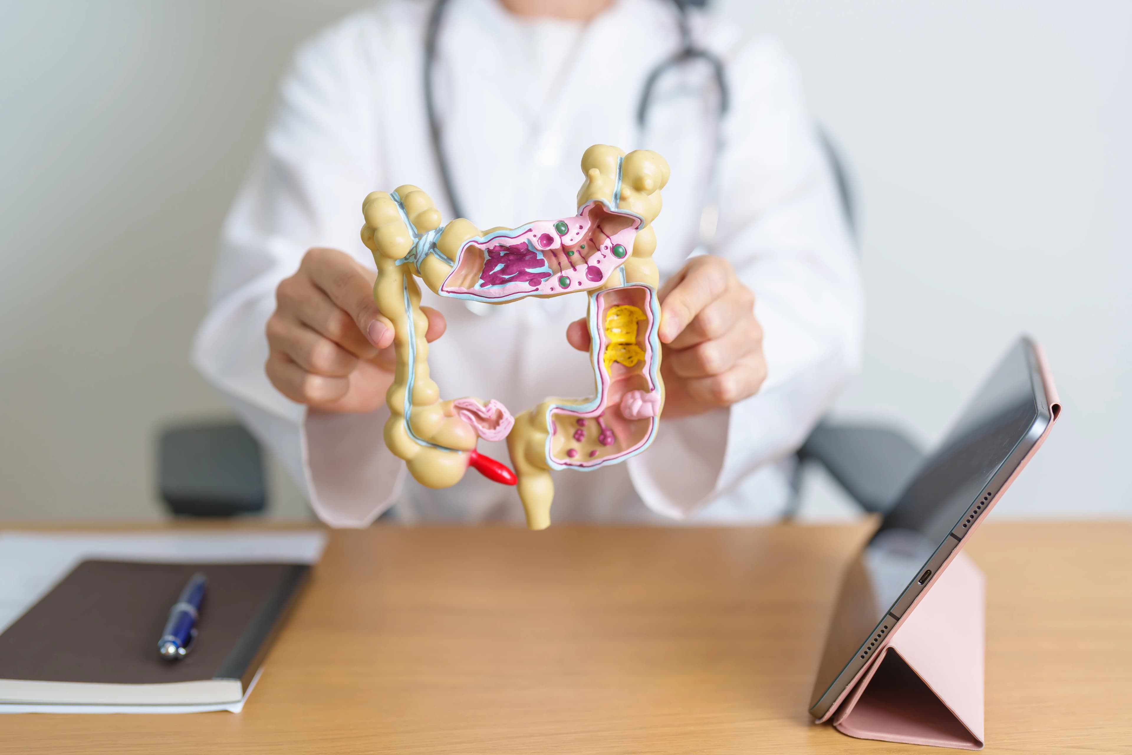 Cáncer Colorrectal en Latinoamérica: Costos y Guía 2026 | KURBUO