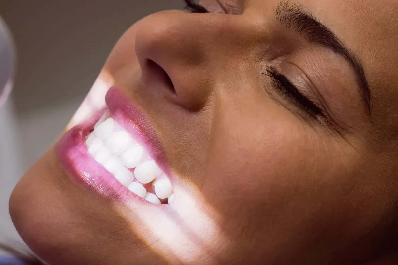 Diseño de sonrisa: qué es y cómo funciona