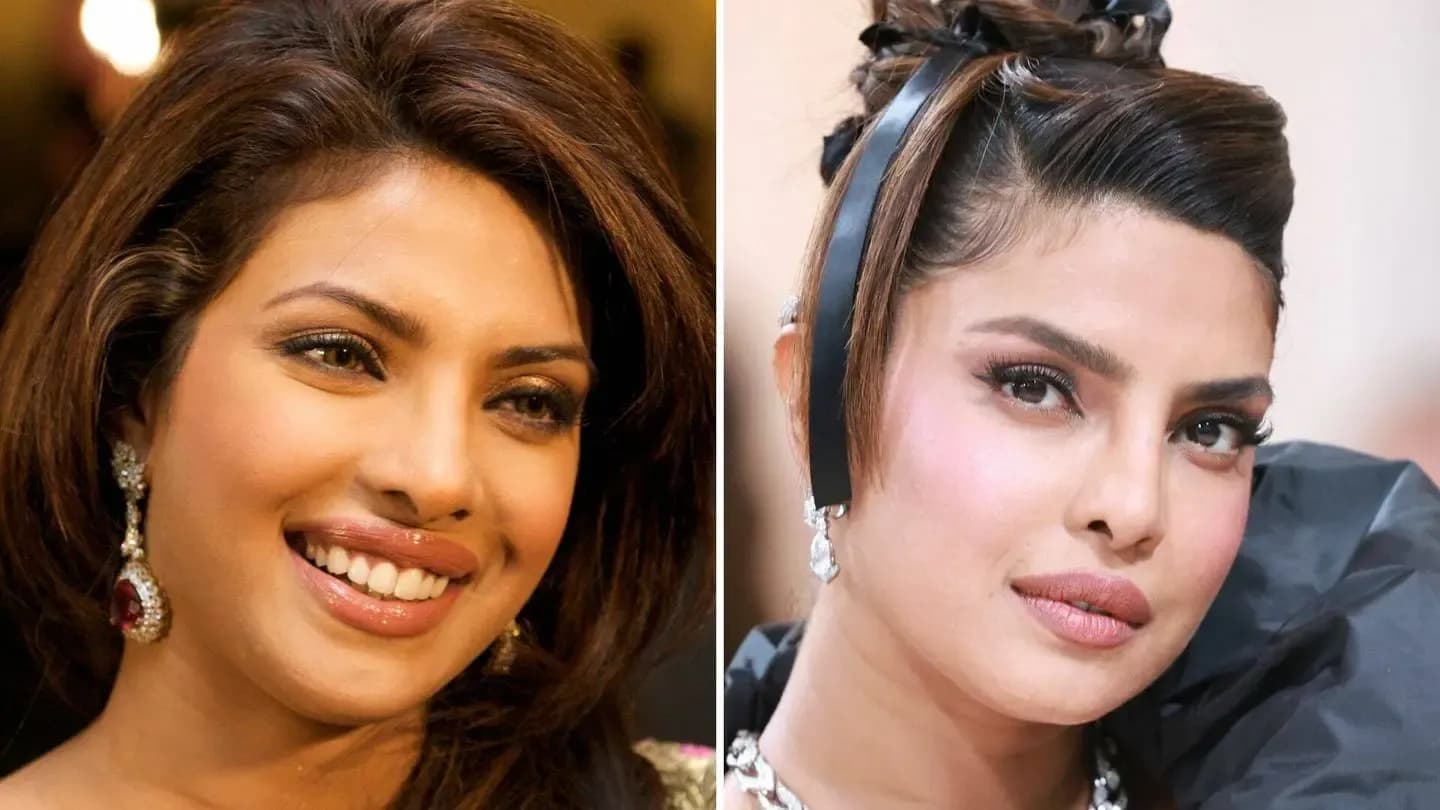 Ethnic Rhinoplasty: What It Is and Why It Requires a Specialist