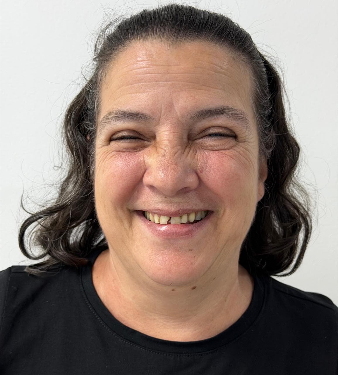 Before LENTES CERAMICOS