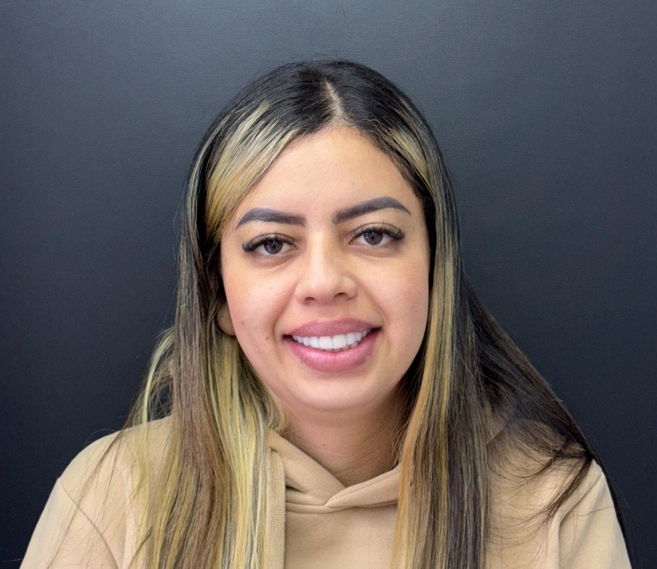 After LENTES CERAMICOS