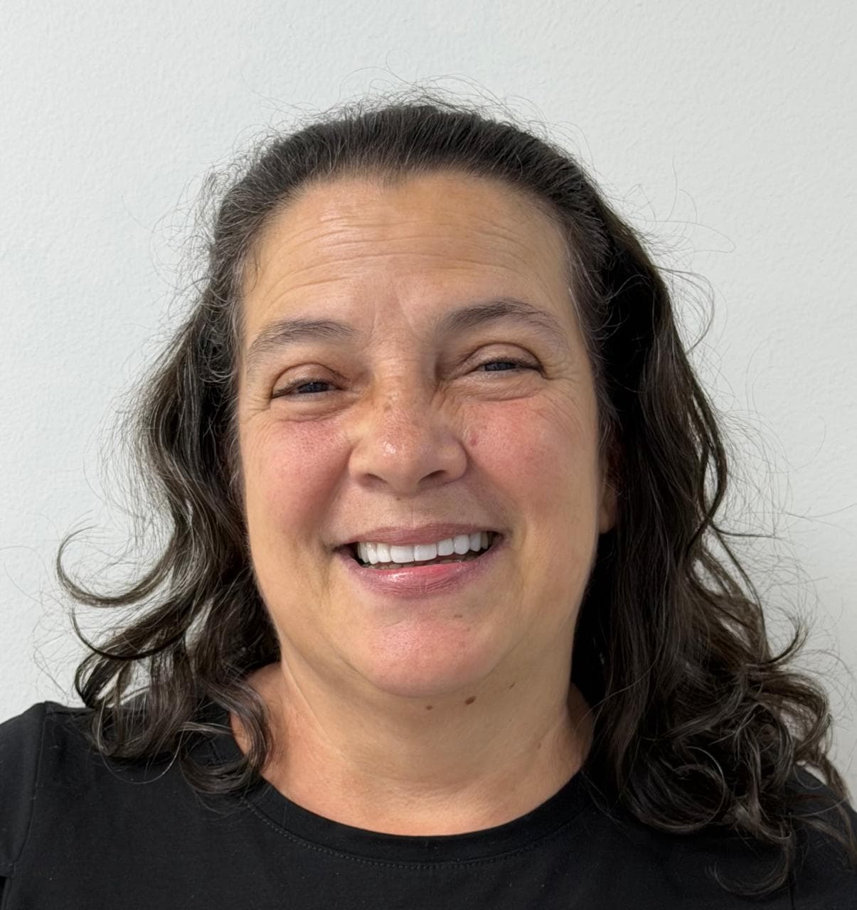 After LENTES CERAMICOS