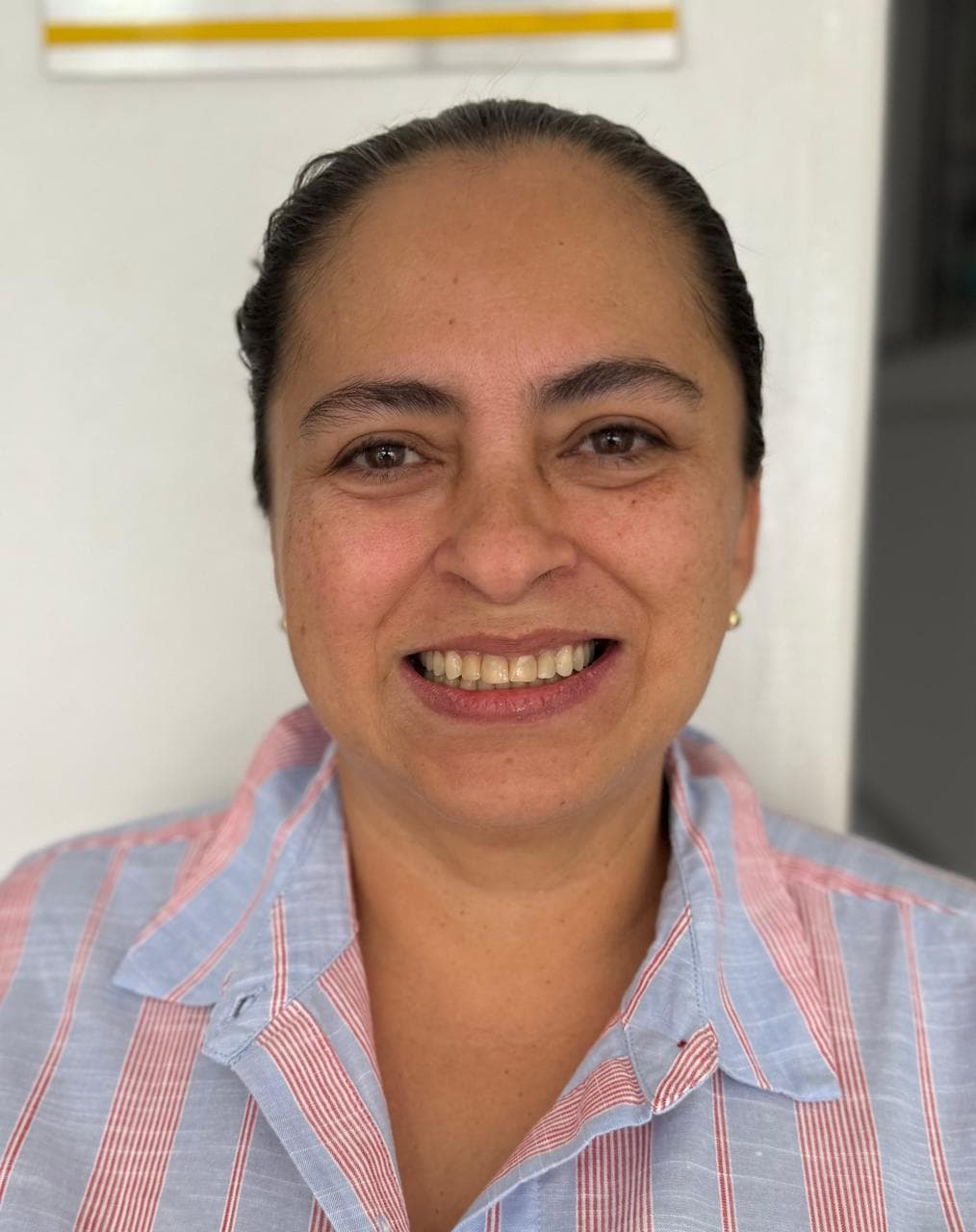 Before LENTES CERAMICOS