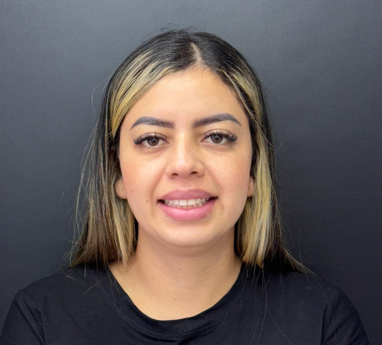 Before LENTES CERAMICOS