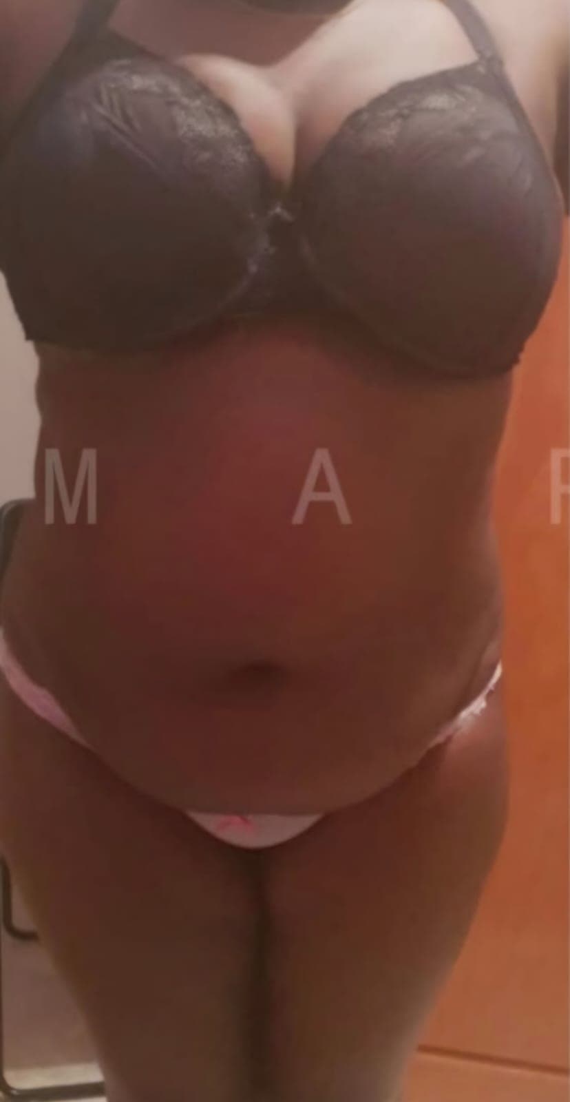 Before Abdominoplastia y liposucción