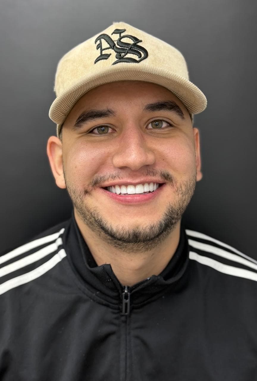 After LENTES CERAMICOS