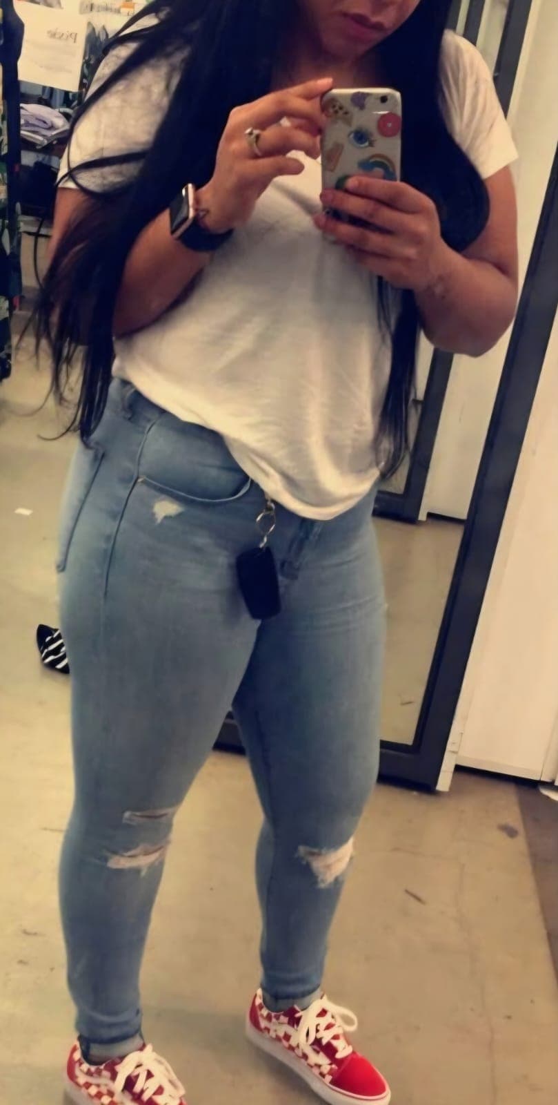 Before Abdominoplastia y liposucción