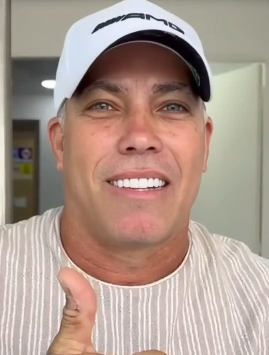 After Luego de ortodoncia con alineadores, se realizan LENTES CERAMICOS.