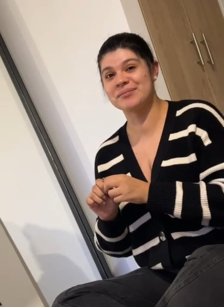 Before Tratamiento de reducción de peso