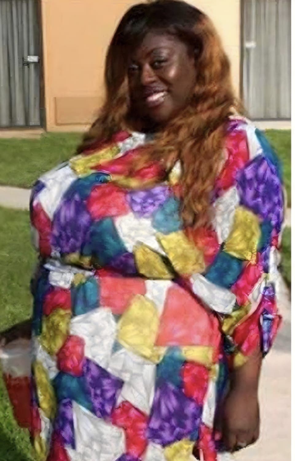 Before Abdominoplastia, liposucción y bbl