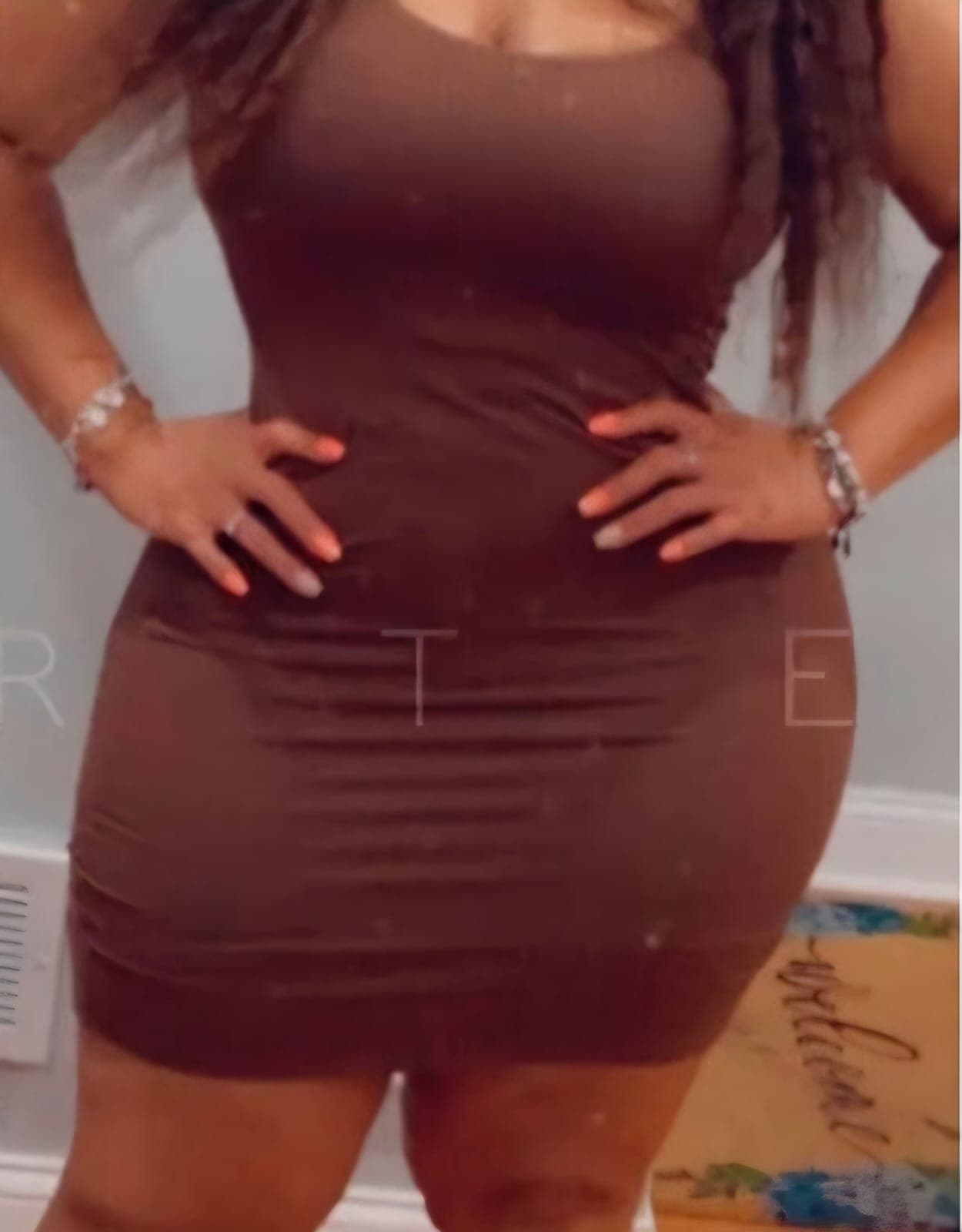 After Abdominoplastia