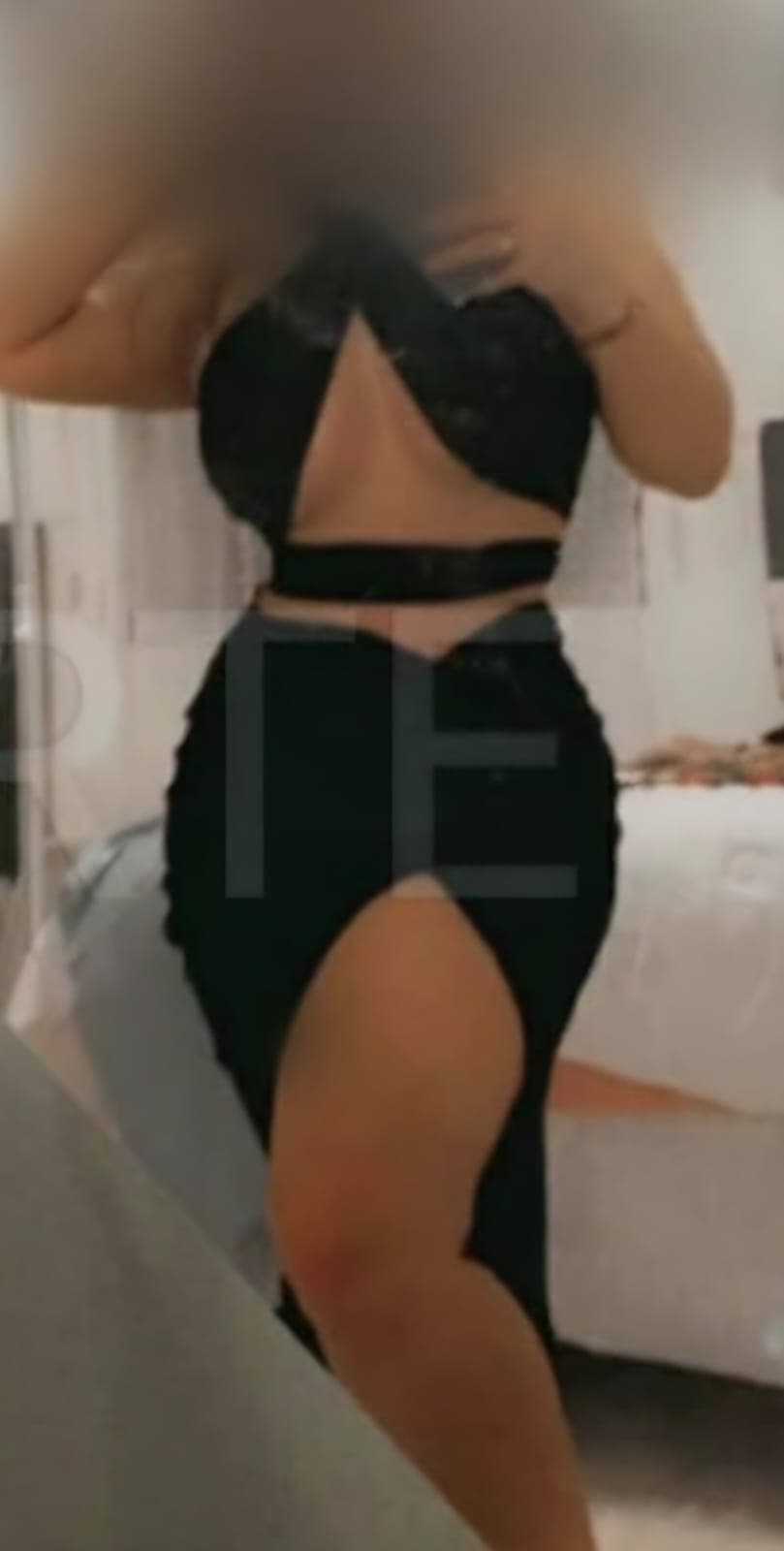 After Abdominoplastia, liposucción y senos