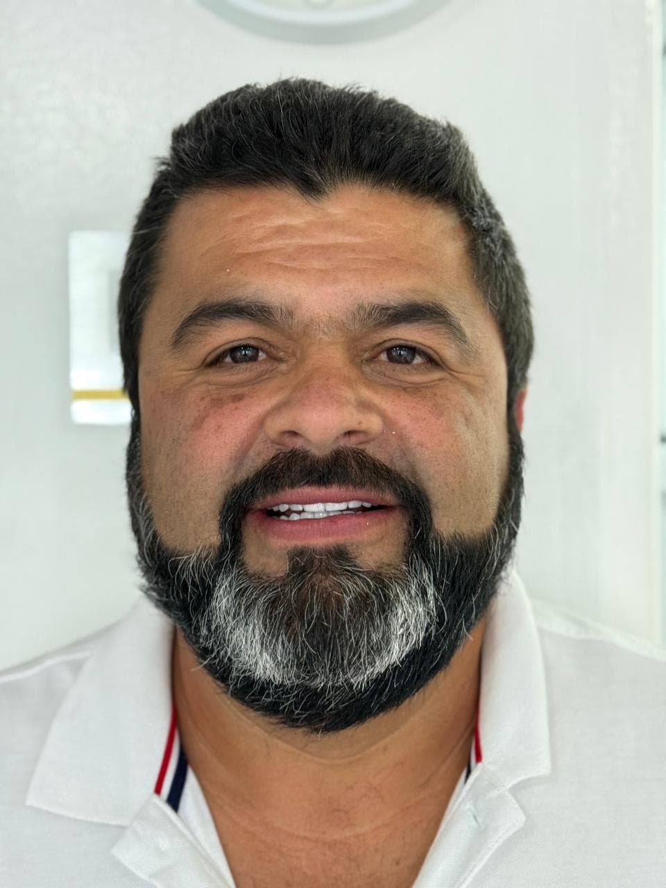 After LENTES CERAMICOS