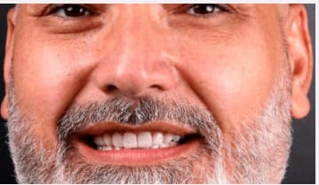 After Diseño. de sonrisa