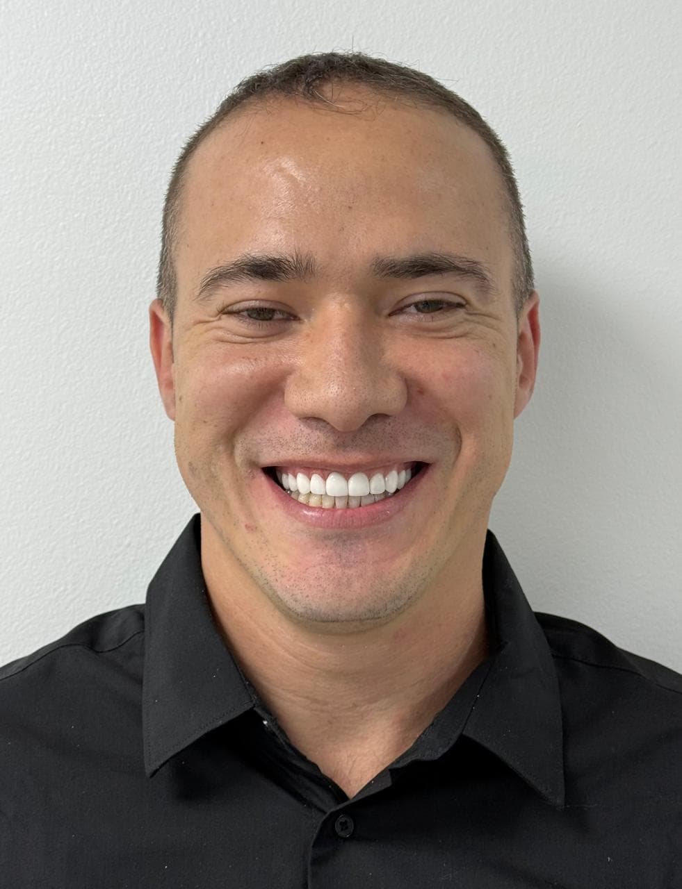 After DISEÑO EN RESINA