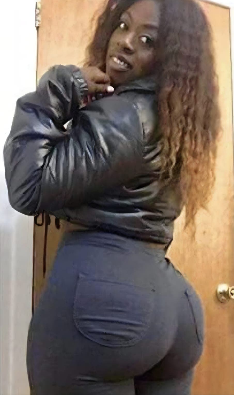 After Abdominoplastia, liposucción y bbl