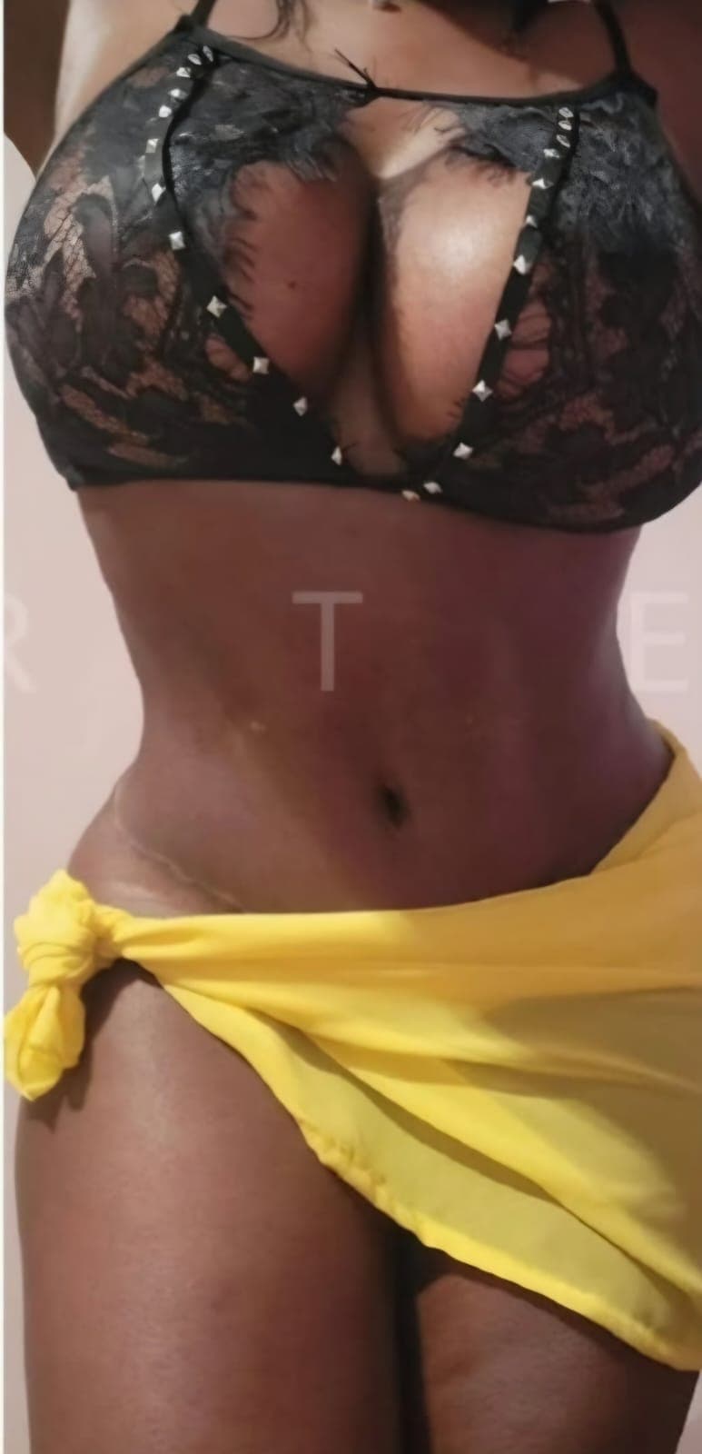 After Abdominoplastia y liposucción