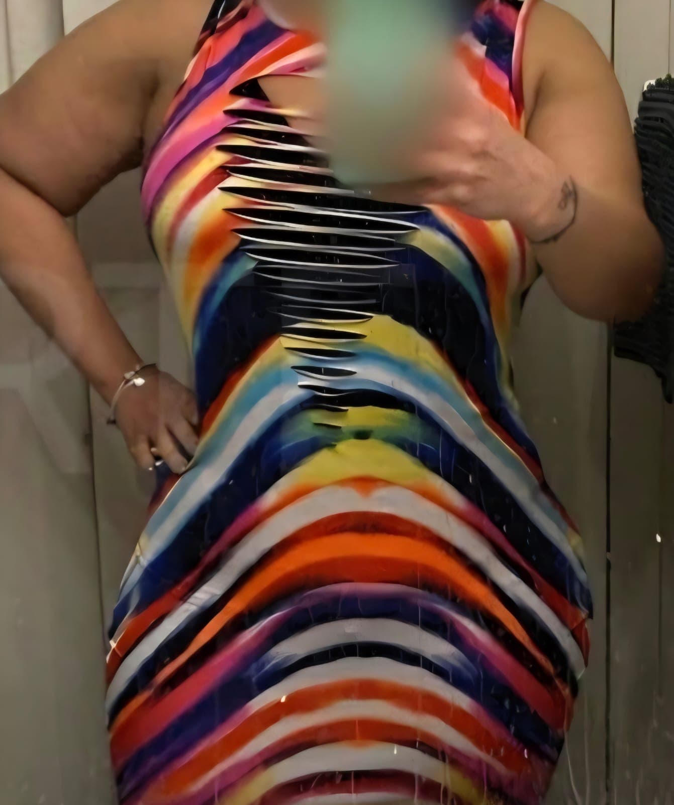 After Abdominoplastia (tummy tuck)